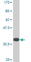 Anti-KDM5B Mouse Monoclonal Antibody [clone: 1G10]