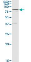 Anti-SP110 Polyclonal Antibody Pair