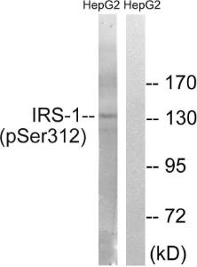 Western blot analysis of lysates from HepG2 cells using Anti-IRS-1 (phospho Ser312) Antibody. The right hand lane represents a negative control, where the antibody is blocked by the immunising peptide.