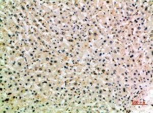 Immunohistochemical analysis of paraffin-embedded human liver using Anti-MSR1 Antibody