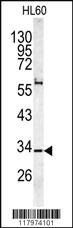 Anti-CAPZA1 Rabbit Polyclonal Antibody