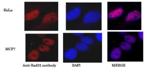 Anti-Rad52 Antibody