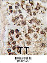 Anti-MLLT10 (AF10) Rabbit Polyclonal Antibody