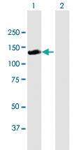 Anti-RALGDS Mouse Polyclonal Antibody