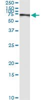 Anti-PCK1 Antibody Pair