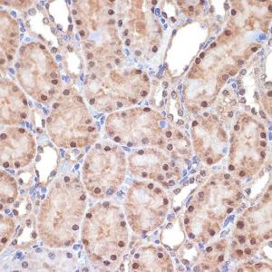 Immunohistochemistry analysis of paraffin-embedded rat kidney using Anti-TNPO3 Antibody [ARC2310] (A308395) at a dilution of 1:100 (40x lens). Perform microwave antigen retrieval with 10 mM Tris/EDTA buffer pH 9.0 before commencing with IHC staining protocol