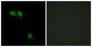 Immunofluorescence analysis of HeLa cells using Anti-IRS-1 (phospho Ser312) Antibody. The right hand panel represents a negative control, where the antibody was pre-incubated with the immunising peptide.