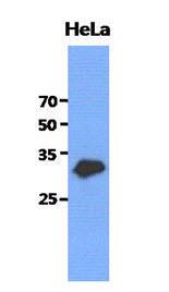 Anti-GCLM Mouse Monoclonal Antibody [clone: 13G1]