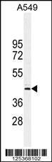 Anti-FAM46D Rabbit Polyclonal Antibody (Biotin)