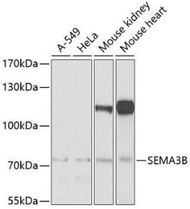 Western blot analysis of extracts of various cell lines, using Anti-SEMA3B Antibody (A10043) at 1:1,000 dilution. The secondary antibody was Goat Anti-Rabbit IgG H&L Antibody (HRP) at 1:10,000 dilution.