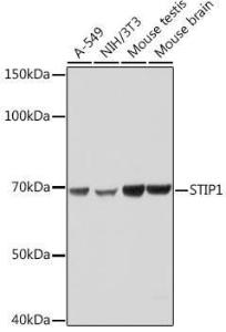 Anti-STIP1/STI1 Rabbit Monoclonal Antibody [Clone: ARC1805]