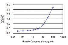 Anti-FEM1A Polyclonal Antibody Pair