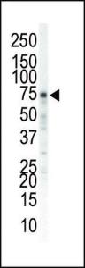 Anti-EPHA5 Rabbit Polyclonal Antibody (AP (Alkaline Phosphatase))