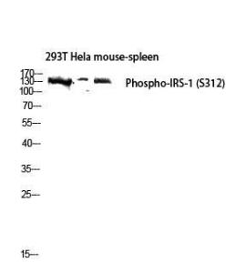 Western blot analysis of 293T Hela mouse spleen lysis using Anti-IRS-1 (phospho Ser312) Antibody