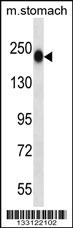 Anti-TNN Rabbit Polyclonal Antibody