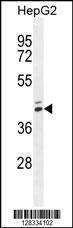 Anti-MAMSTR Rabbit Polyclonal Antibody (AP (Alkaline Phosphatase))