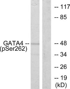 Anti-GATA4