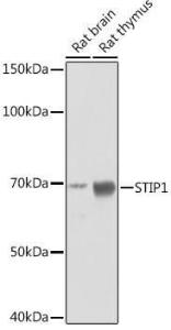 Anti-STIP1/STI1 Rabbit Monoclonal Antibody [Clone: ARC1805]