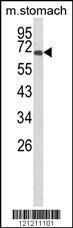 Anti-GLIS1 Rabbit Polyclonal Antibody (HRP (Horseradish Peroxidase))