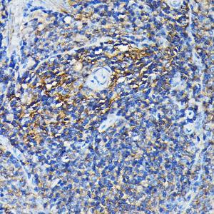 Immunohistochemistry analysis of paraffin-embedded rat spleen using Anti-PRC1 Antibody (A10047) at a dilution of 1:100 (40X lens). Perform high pressure antigen retrieval with 10 mM citrate buffer pH 6.0 before commencing with IHC staining protocol