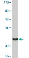 Anti-STAT5A Mouse Monoclonal Antibody [clone: 1E3]