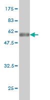 Anti-TSSK3 Mouse Monoclonal Antibody [clone: 3E6]