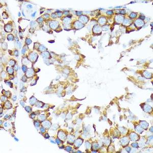 Anti-STIP1/STI1 Rabbit Monoclonal Antibody [Clone: ARC1805]