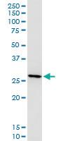 Anti-LGALS3 Mouse Monoclonal Antibody [clone: 3G8]