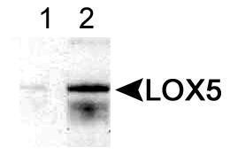 Anti-DEFA5 Mouse Monoclonal Antibody (Biotin) [clone: 8C8]