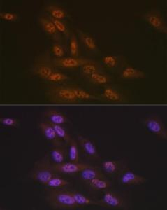 Immunofluorescence analysis of U-2 OS cells using Anti-TNPO3 Antibody [ARC2310] (A308395) at a dilution of 1:100 (40x lens). DAPI was used to stain the cell nuclei (blue)