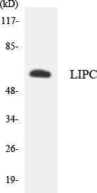 Western blot analysis of the lysates from HT 29 cells using Anti-LIPC Antibody