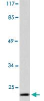 Anti-CDKN2A Rabbit Polyclonal Antibody