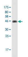 Anti-CARHSP1 Mouse Monoclonal Antibody [clone: 4G10]