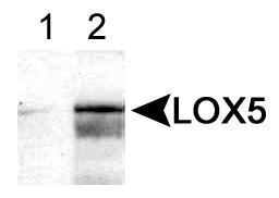 Anti-ALOX5 Rabbit Polyclonal Antibody