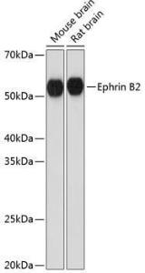 Western blot analysis of extracts of various cell lines, using Anti-Ephrin B2 Antibody [ARC0576] (A80671) at 1:1000 dilution