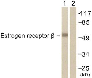 Anti-Estrogen Receptor-beta antibody