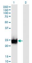 Anti-LGALS3 Mouse Monoclonal Antibody [clone: 3G8]