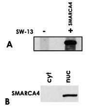 Anti-SMARCA4 Mouse Monoclonal Antibody [clone: BRG-01]