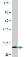 Anti-TMSB10 Mouse Monoclonal Antibody [clone: 2E3]