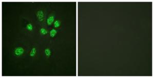 Anti-Estrogen Receptor-beta antibody