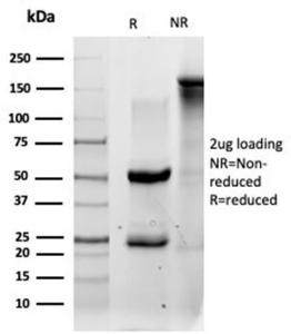 SDS-PAGE analysis of Anti-QKI Antibody [PCRP-QKI-2F10] under non-reduced and reduced conditions; showing intact IgG and intact heavy and light chains, respectively. SDS-PAGE analysis confirms the integrity and purity of the antibody