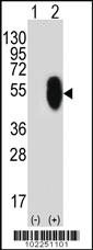 Anti-MLLT6 Rabbit Polyclonal Antibody