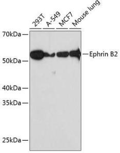 Western blot analysis of extracts of various cell lines, using Anti-Ephrin B2 Antibody [ARC0576] (A80671) at 1:1000 dilution