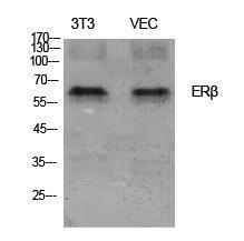 Anti-Estrogen Receptor-beta antibody