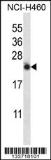 Anti-IL13 Rabbit Polyclonal Antibody