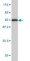 Anti-TSSK3 Mouse Monoclonal Antibody [clone: 6H4]