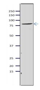 Anti-MCM5 antibody