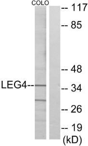 Western blot analysis of lysates from COLO cells using Anti-LEG4 Antibody. The right hand lane represents a negative control, where the antibody is blocked by the immunising peptide.