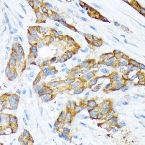 Anti-STIP1/STI1 Rabbit Monoclonal Antibody [Clone: ARC1805]