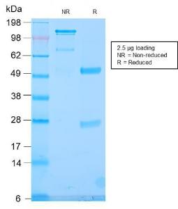 SDS-PAGE analysis of Anti-TLE1 Antibody [TLE1/2946R] under non-reduced and reduced conditions; showing intact IgG and intact heavy and light chains, respectively. SDS-PAGE analysis confirms the integrity and purity of the antibody.